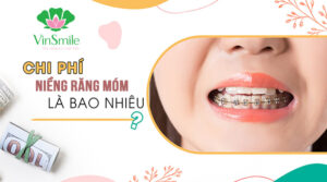 chi-phi-nieng-rang-mom